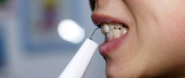 电动牙刷做不到的事它可以！素诺智能可视超声波洁牙仪T11Pro电动牙刷做不到的事它可以！素诺智能可视超声波洁牙仪T11Pro测评测评